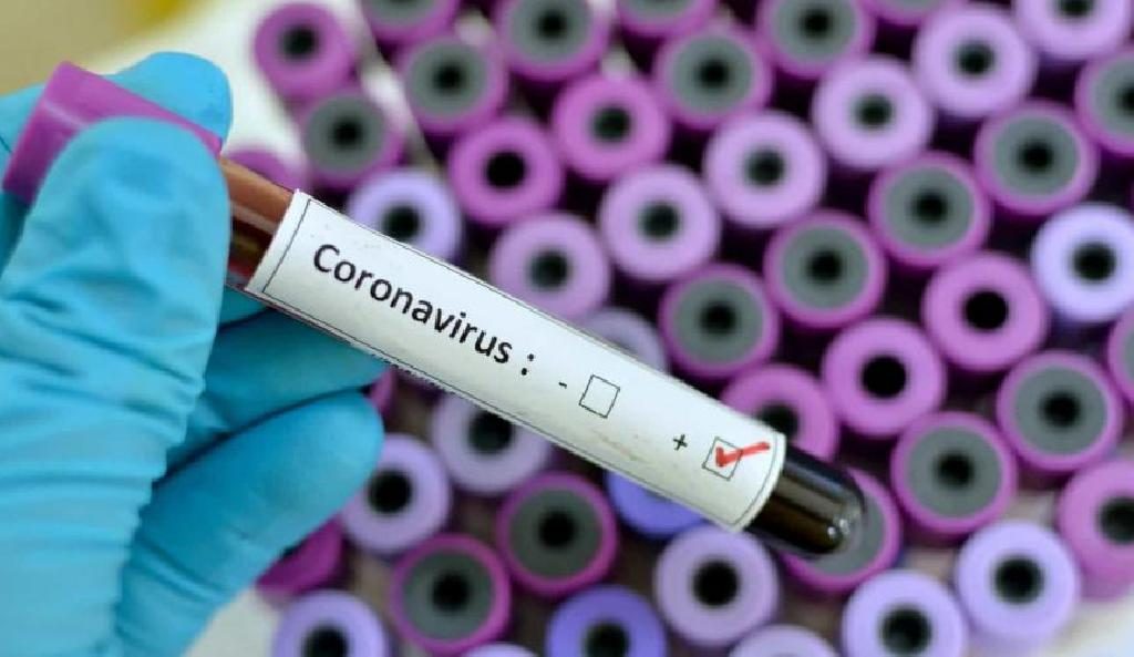 Coronavírus já contagiou 10 milhões de pessoas no mundo